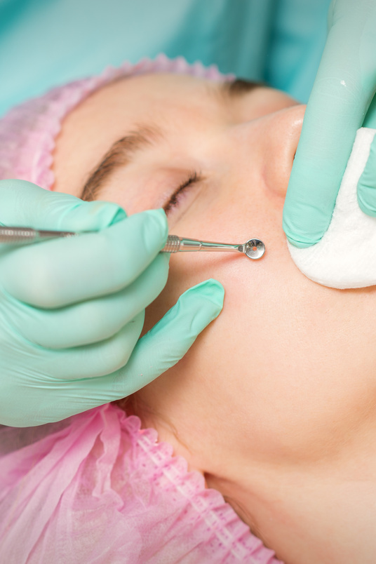 The Beautician Removes Blackhead and Acne on the Female Face in a Beauty Salon, Blackhead Removal Tool.